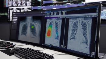 Lunit INSIGHT CXR as shown on a desktop computer