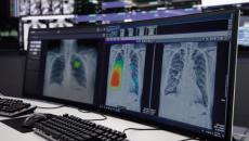 Lunit INSIGHT CXR as shown on a desktop computer
